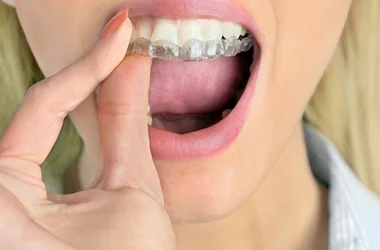 TMJ Joint Disorders or Nightguard