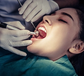  Filings
                                                    and Roots Canals